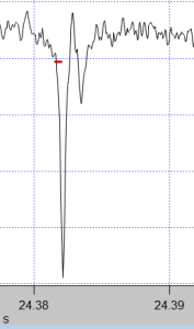 This is the timepoint of threshold crossing I would like to detect and then move on to the next spike a few e.g. 10 ms later.