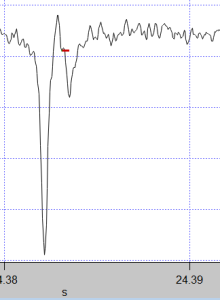 This is the 2nd threshold crossing within the same spike, that I would like to ignore instead of replacing the first one.